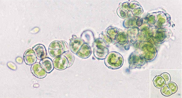 Pozorování buněk zrněnky
