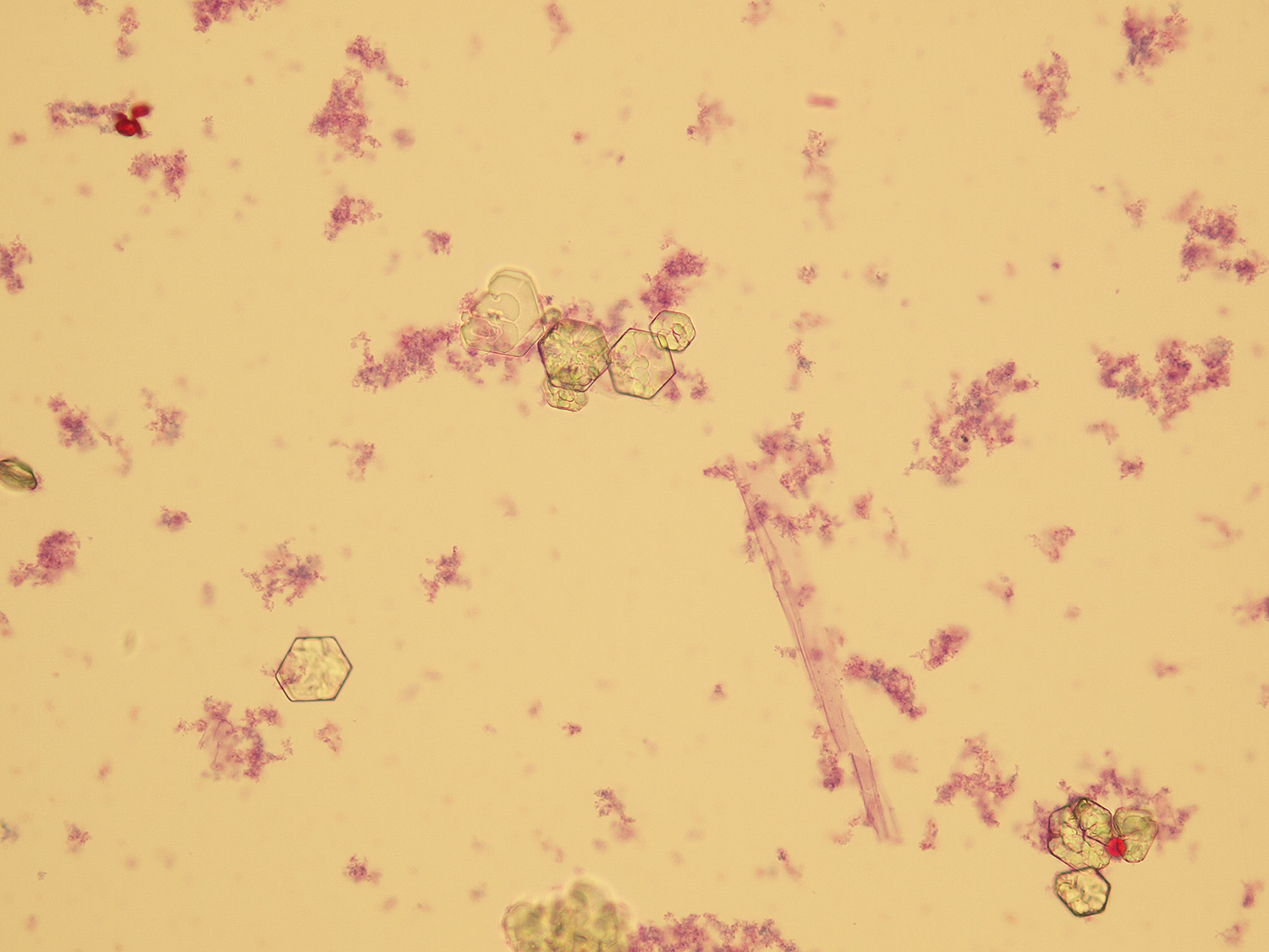Microscopic Analysis Of Urine Faculty Of Medicine Masaryk University 5228