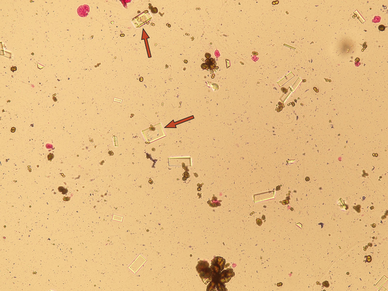 Microscopic Analysis Of Urine Faculty Of Medicine Masaryk University 8004
