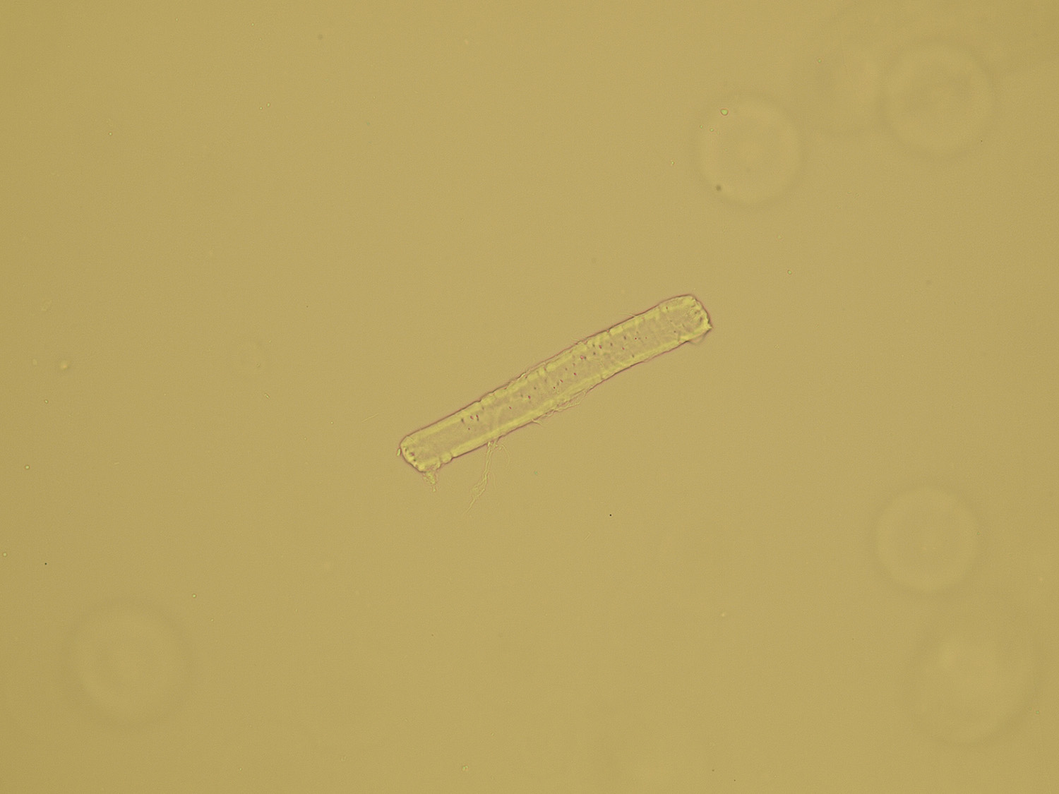 Artifacts Microscopic Analysis Of Urine Faculty Of Medicine Masaryk University 9686