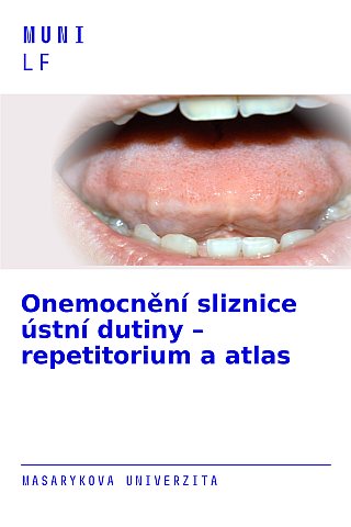 Onemocnění sliznice ústní dutiny – repetitorium a atlas