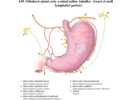 Odtokové mízní cesty a mízní uzliny žaludku – trunci et nodi lymphatici gastrici