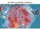 Aktivované destičky – trombocyty