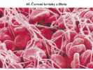 Červené krvinky a fibrin