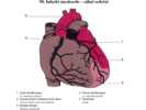 Infarkt myokardu – záhať srdeční