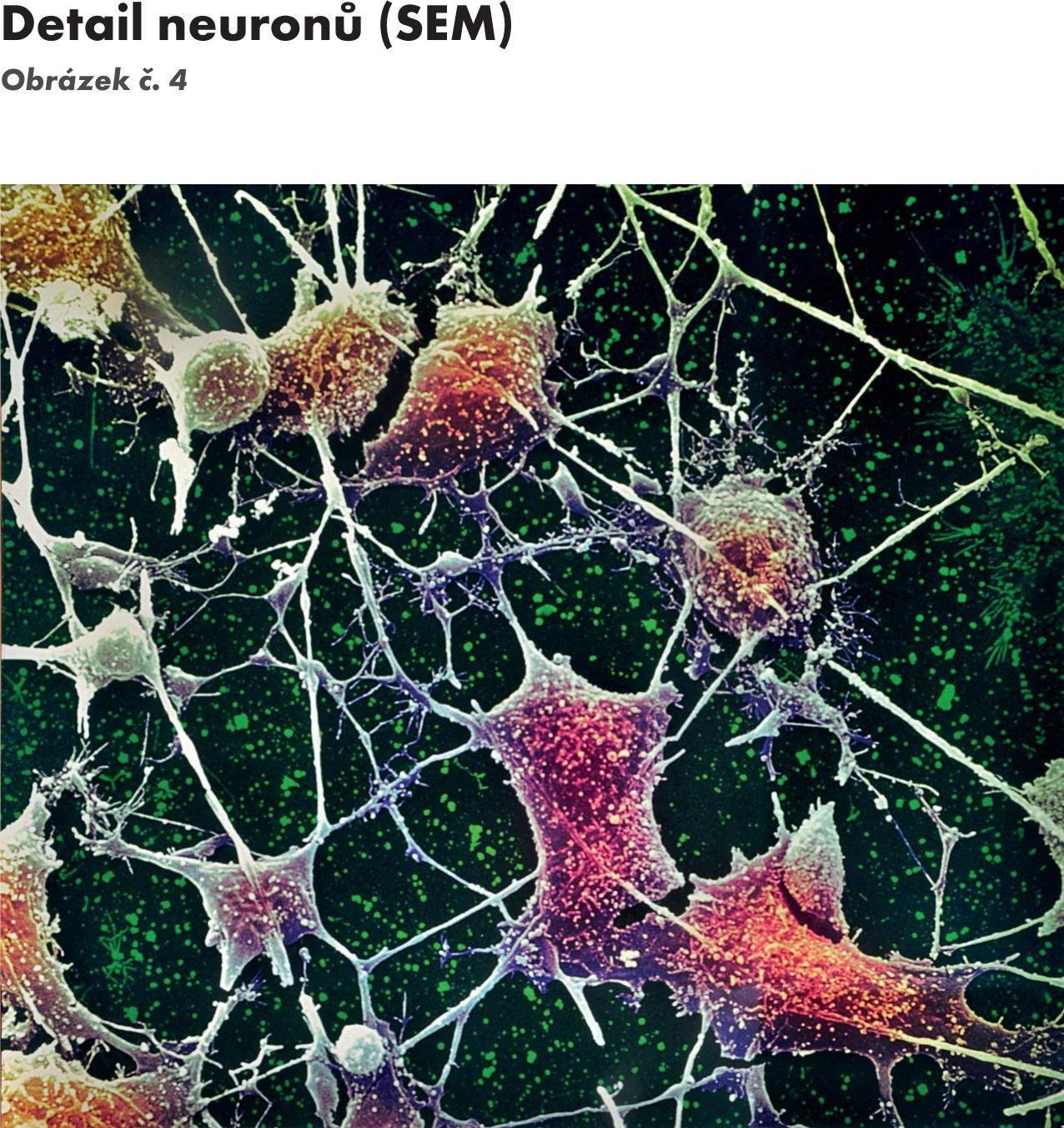 Восстановление клеток мозга. Аксон нейрона микрофотография. Нервные клетки микрофотография. Синапс микроскоп. Клетки мозга под микроскопом.