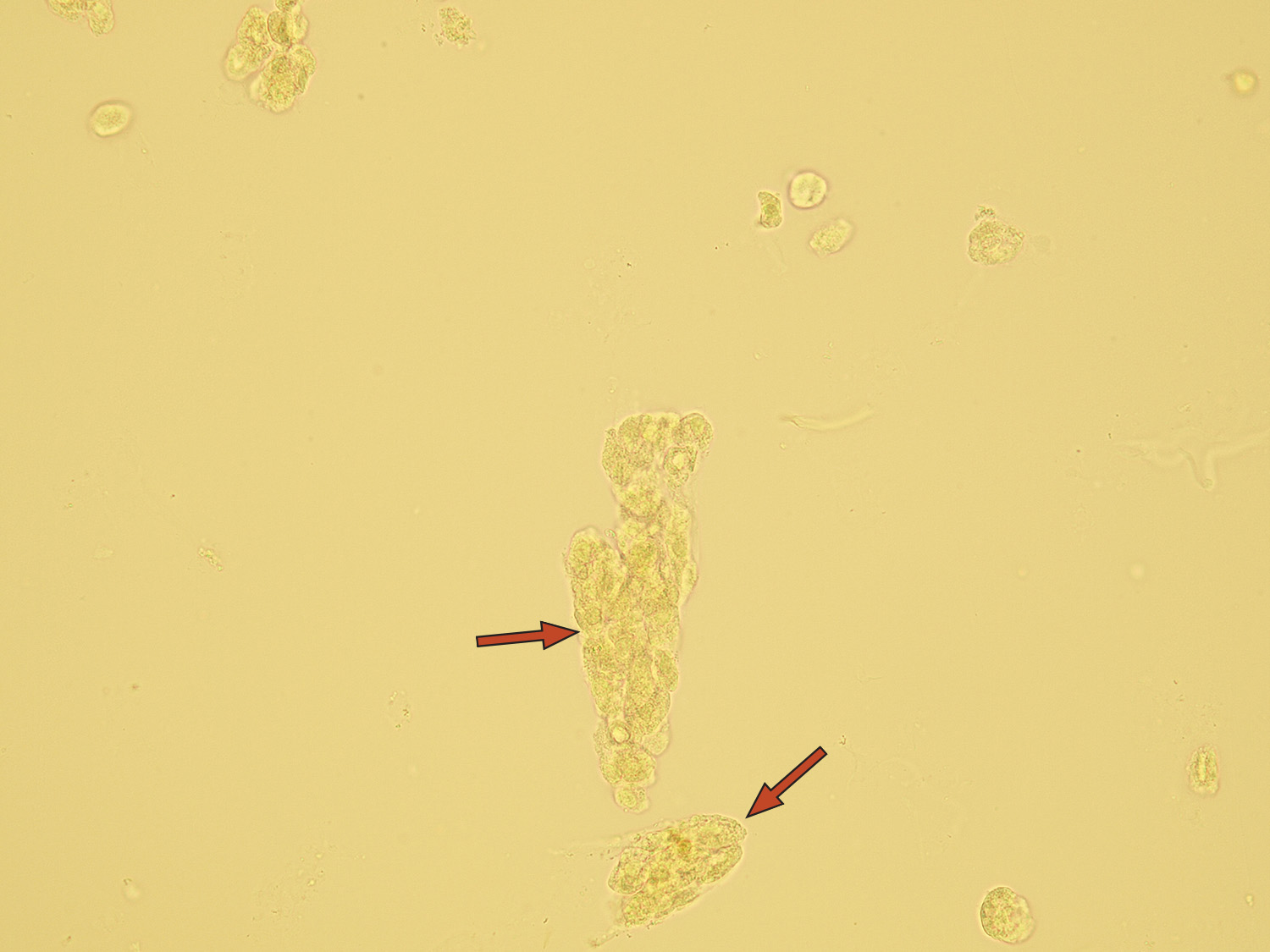 Microscopic Analysis Of Urine Faculty Of Medicine Masaryk University