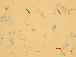 Mucus
