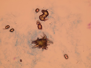 Microscopic Analysis of Urine