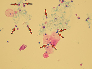 Leukocytes (granulocytes)
