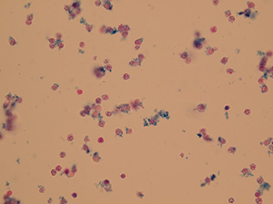 Leukocytes (granulocytes)