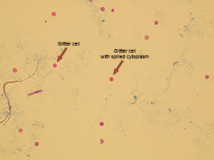 Granulocytes – glitter cells