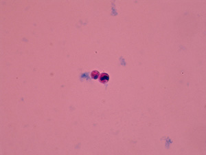 Leukocytes (monocytes), 1000× magnification