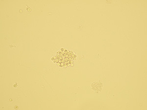 Group of leukocytes