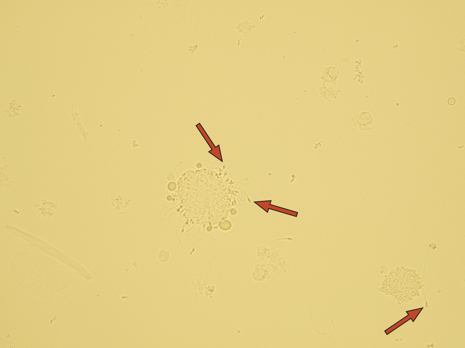 Microscopic Analysis Of Urine Faculty Of Medicine Masaryk University 5831