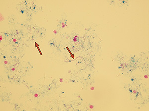 PProbarvené bakterie – koky (řetízkující i jednotlivé)