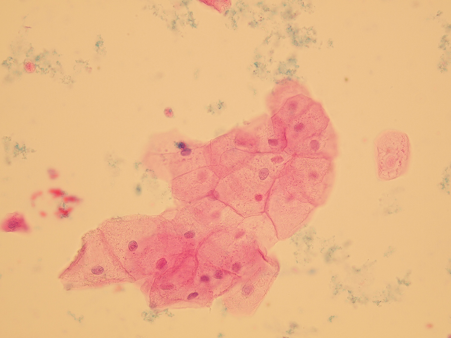 Microscopic Analysis Of Urine Faculty Of Medicine Masaryk University 6883