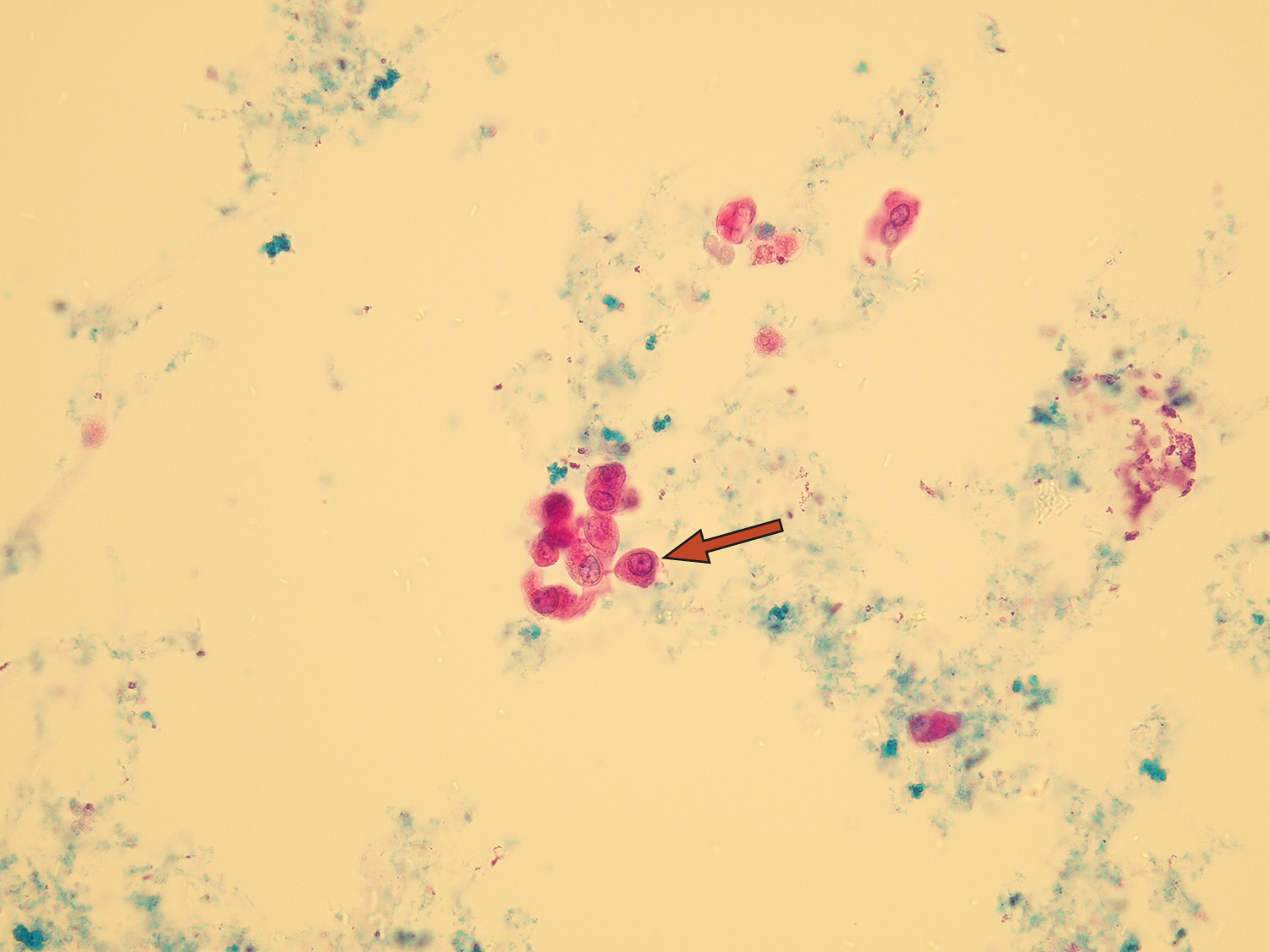 Renal Epithelium In Urine 6566