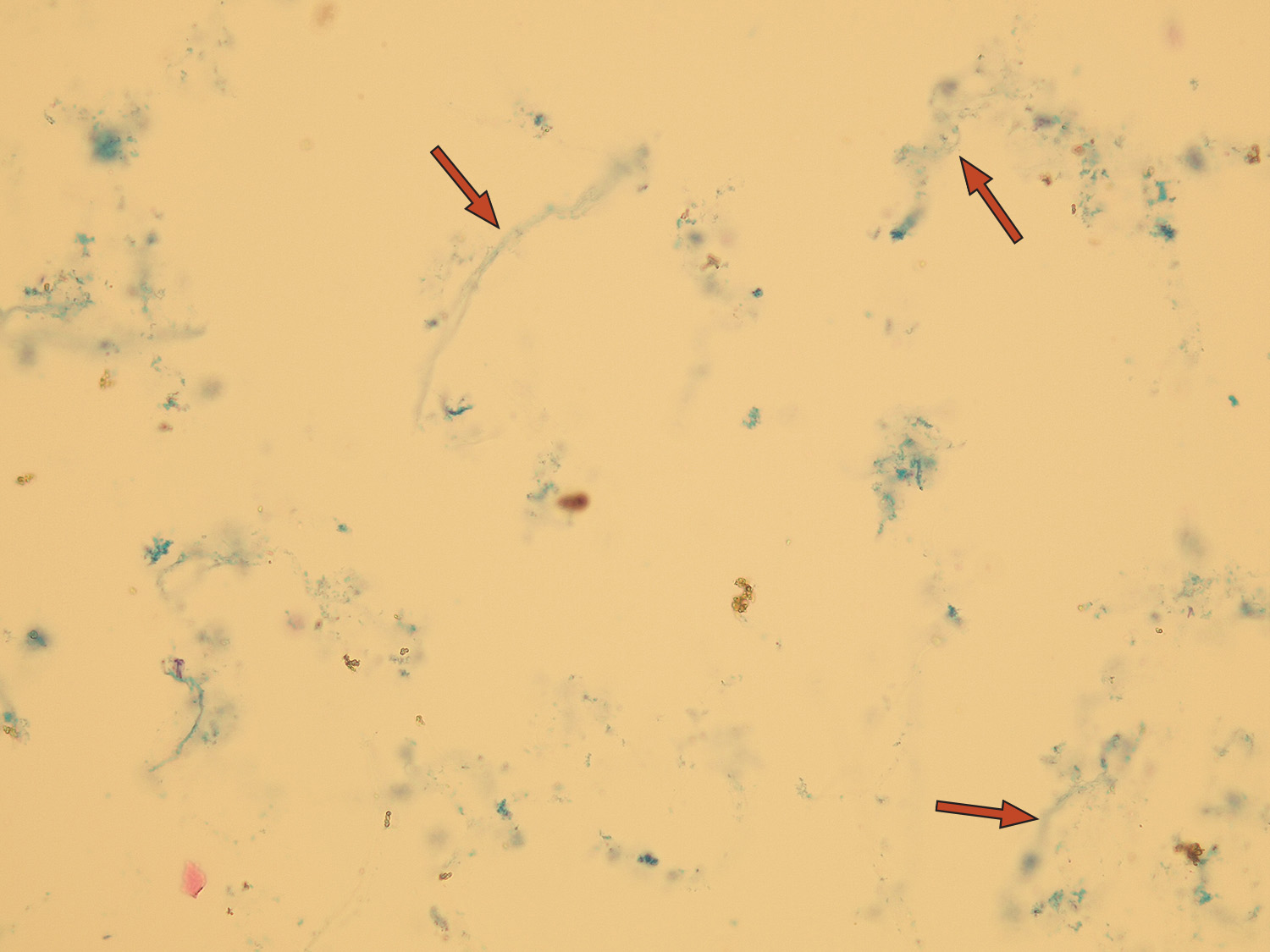 Microscopic Analysis Of Urine Faculty Of Medicine Masaryk University 6579