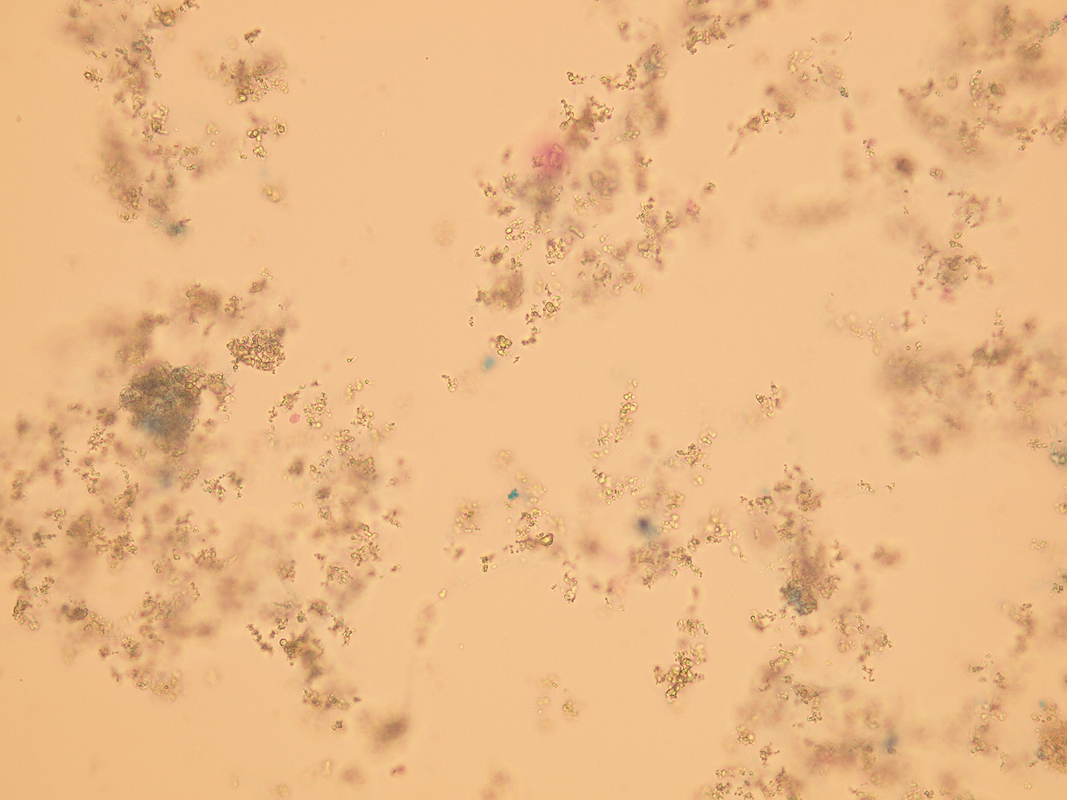 Microscopic Analysis Of Urine Faculty Of Medicine Masaryk University