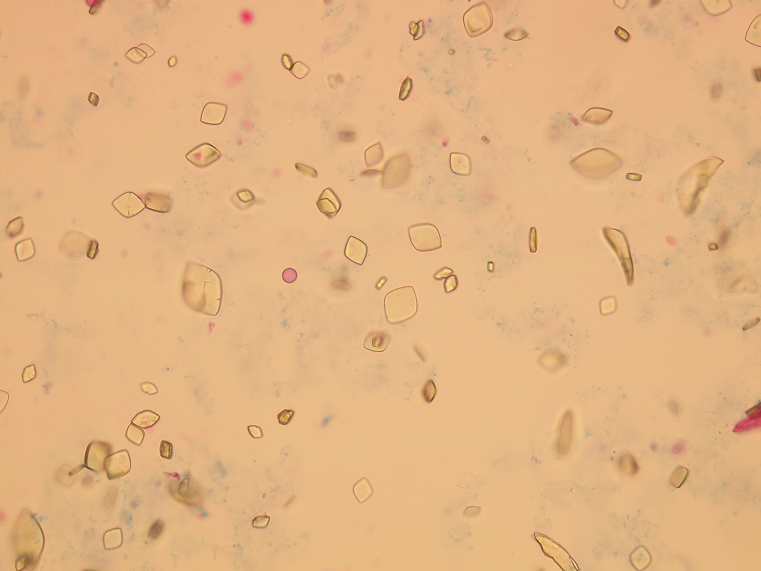 Высокая соль в моче. Соли оксалаты в моче микроскопия. Кристаллы оксалата кальция микроскопия. Соли в моче микроскопия Ураты. Кристаллы Ураты.