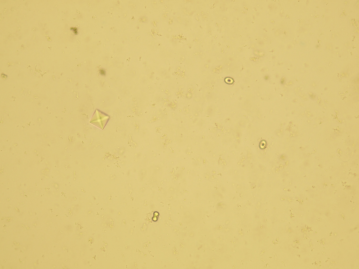 Microscopic Analysis of Urine | Faculty of Medicine, Masaryk University