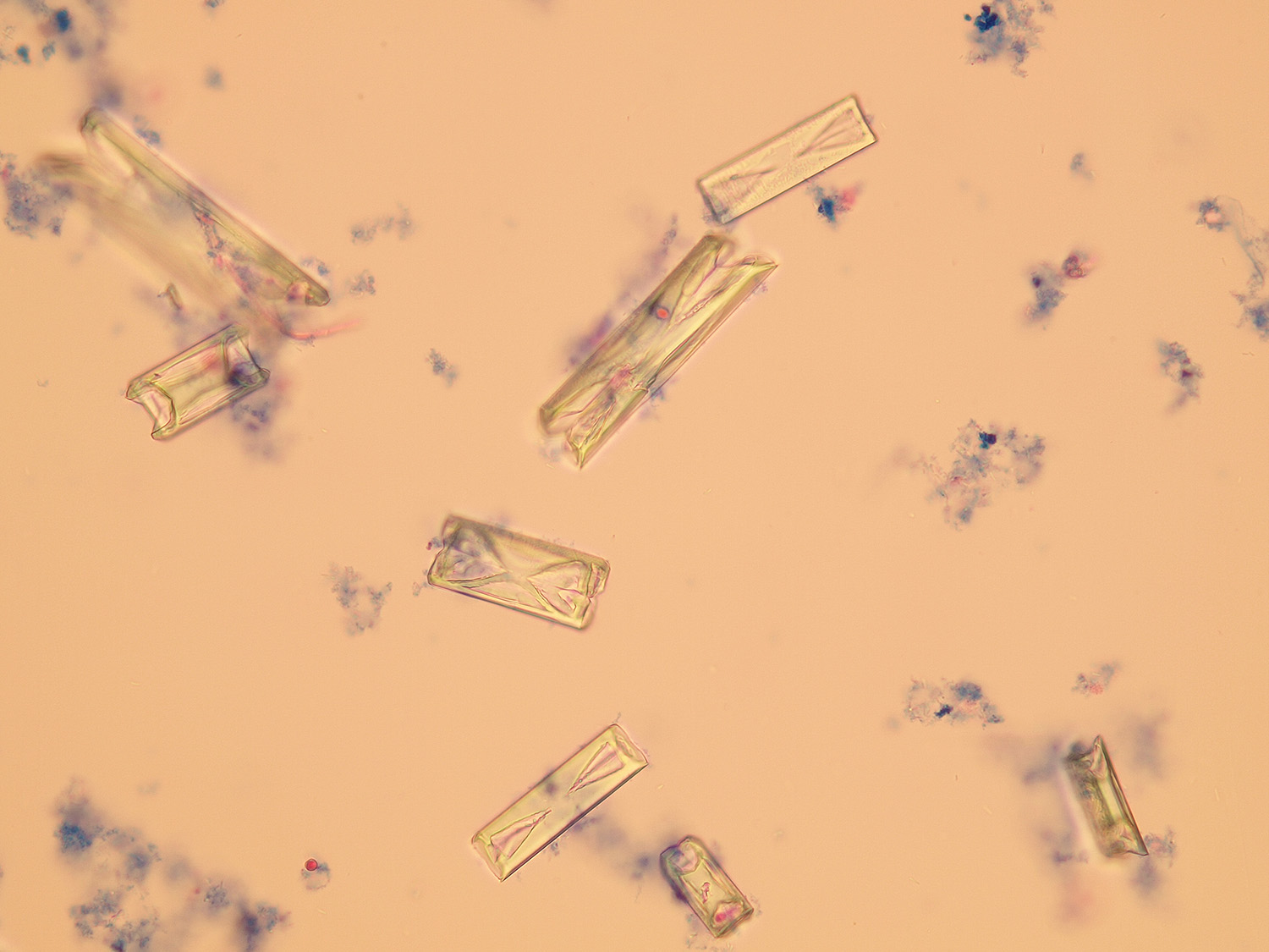 Microscopic Analysis Of Urine Faculty Of Medicine Masaryk University 7939