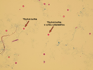 Granulocyty – třpytivé buňky