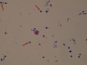 Leukocyty (lymfocyty – šipky)