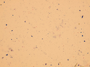 Neprobarvené bakterie – tyčky a řetízkující koky