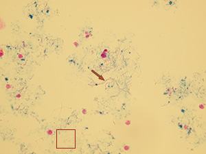 Probarvené bakterie – koky (výřez) a protoplast (šipka)