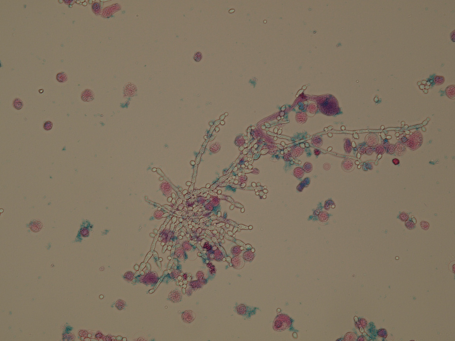 Microscopic Analysis of Urine | Faculty of Medicine, Masaryk University