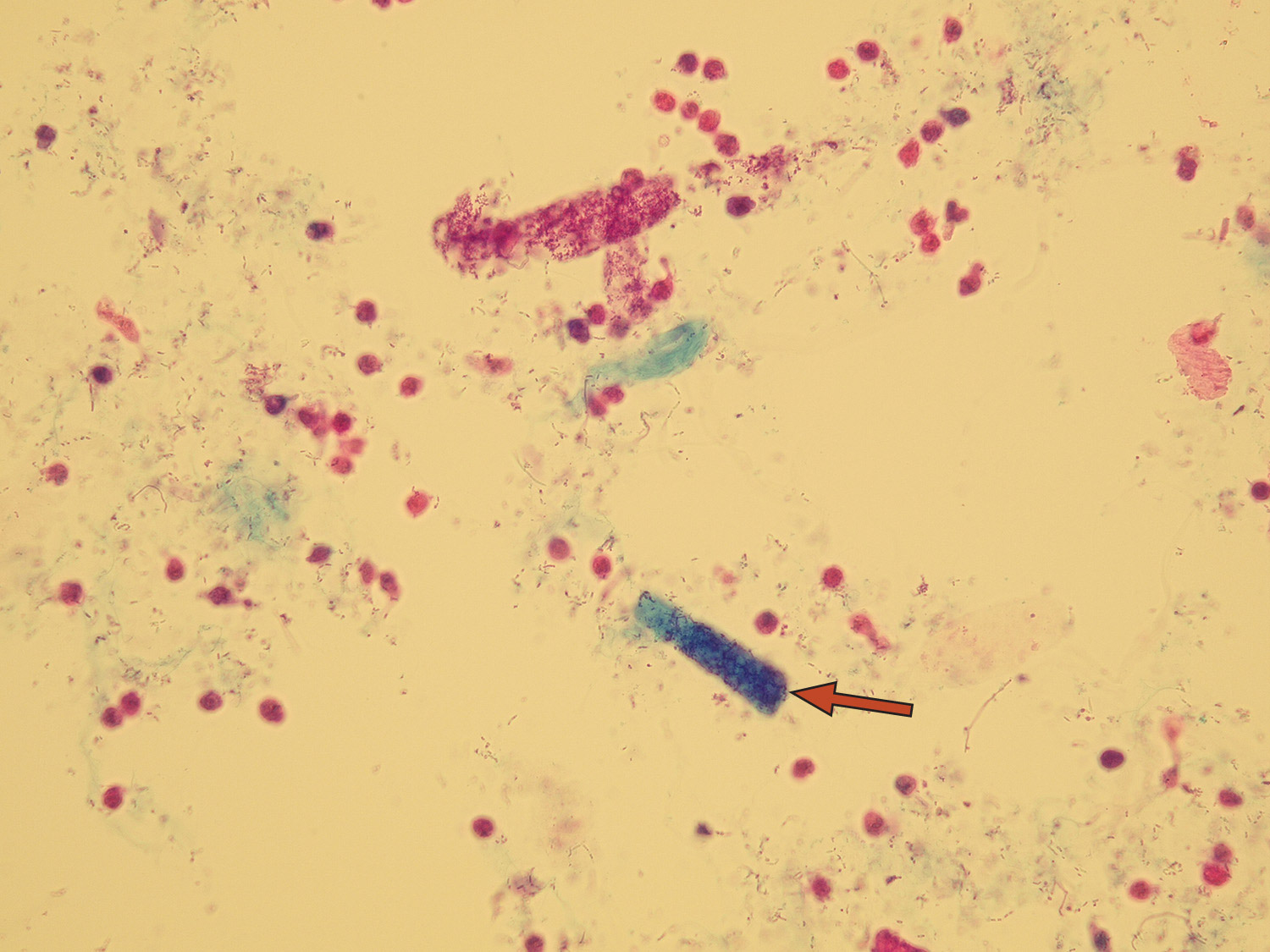 Microscopic Analysis of Urine | Faculty of Medicine, Masaryk University