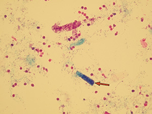 Bacterial cast