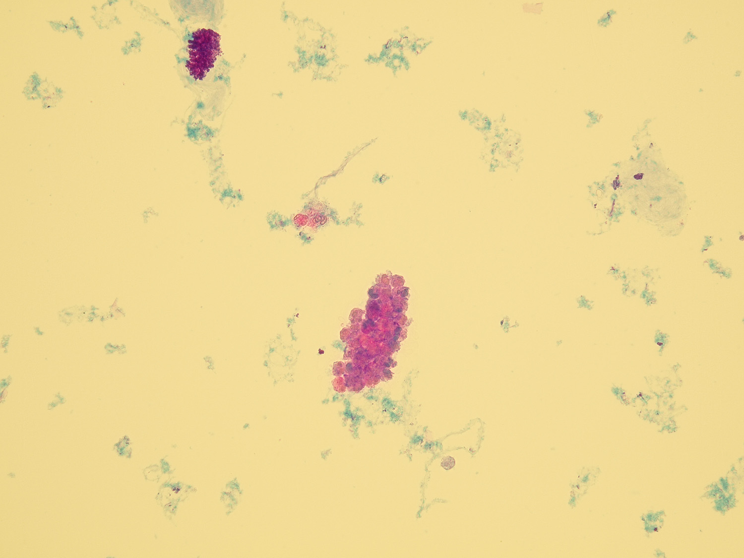 Microscopic Analysis of Urine | Faculty of Medicine, Masaryk University