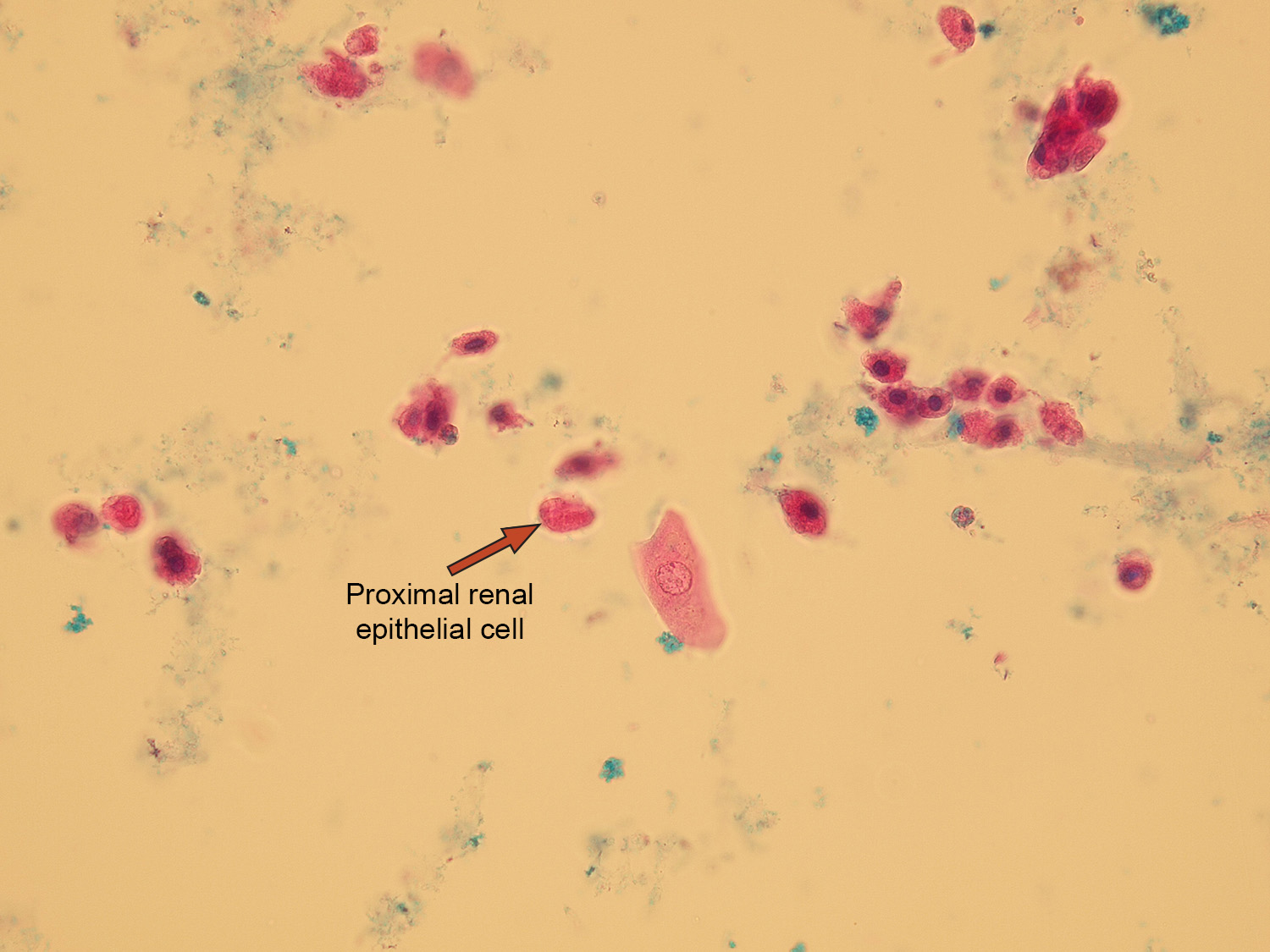 Epithelial Cells In Urine 2348