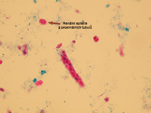 Renální tubulární epitelie