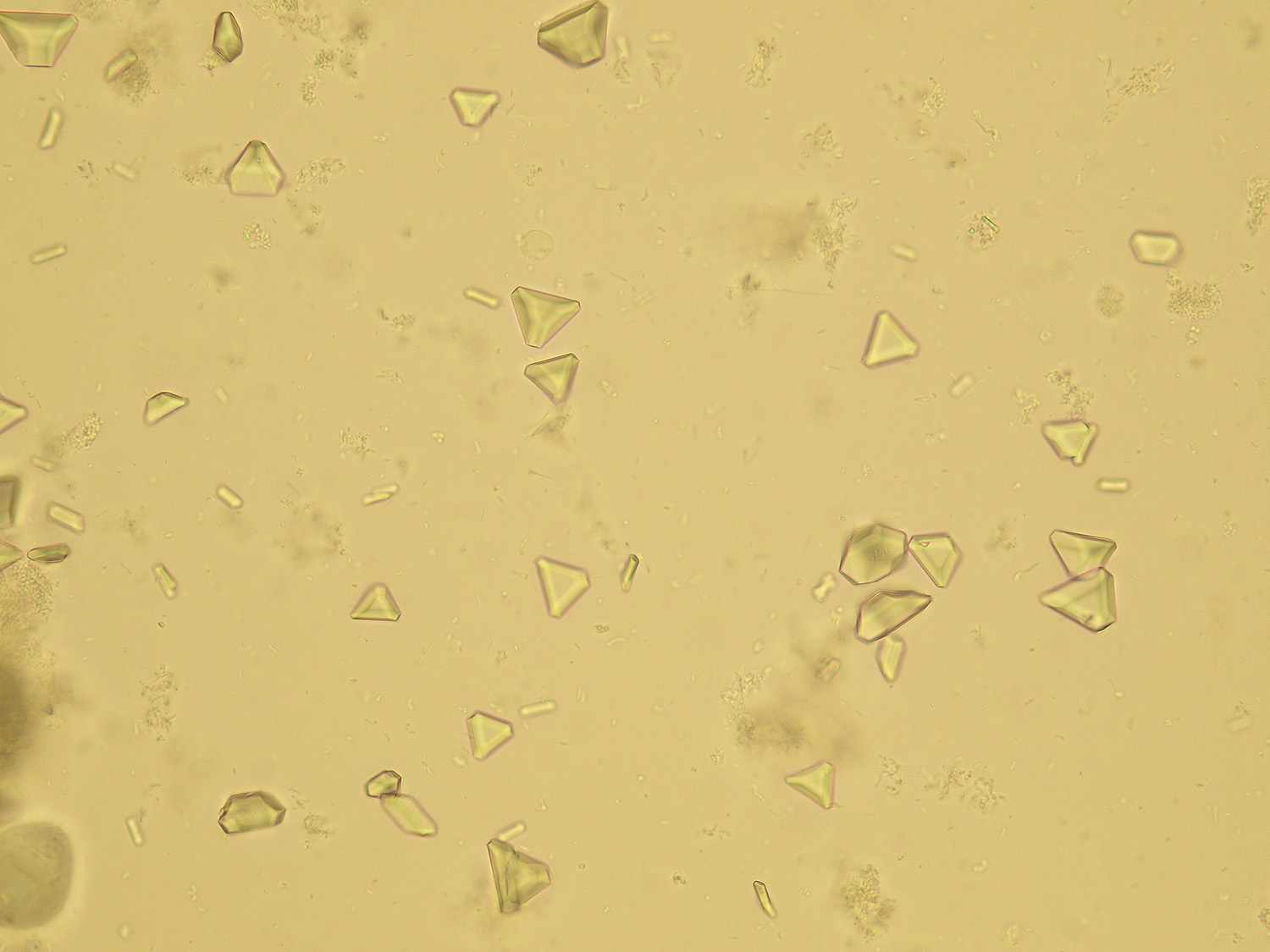 Crystals Microscopic Analysis Of Urine Faculty Of Medicine Masaryk University 8924