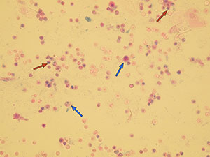 Monocyty (oranžové šipky) a aktivované monocyty (modré šipky)