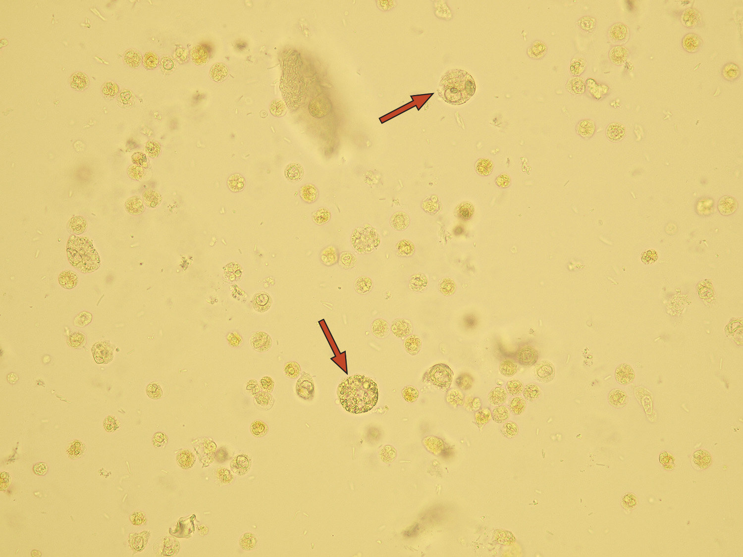 Leukocytes Wbcs Microscopic Analysis Of Urine Faculty Of Medicine Masaryk University 1886
