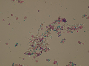 Yeast pseudomycelium