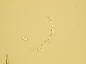 Yeast pseudomycelium