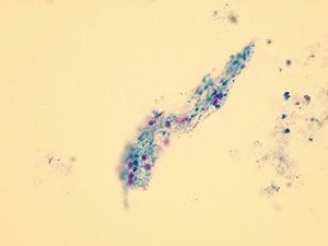 Bacterial cast