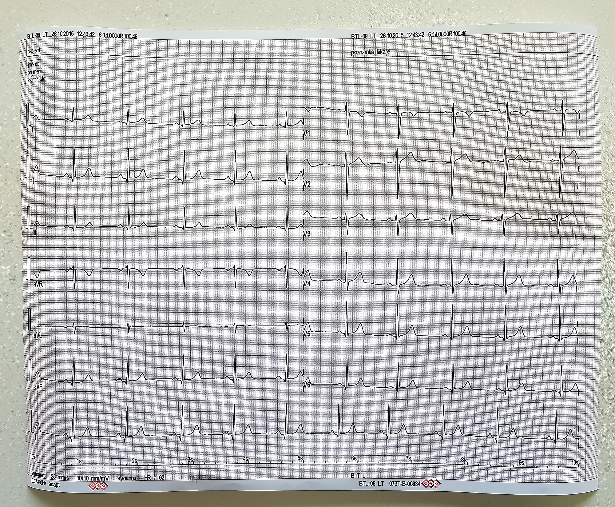Elektrokardiogram