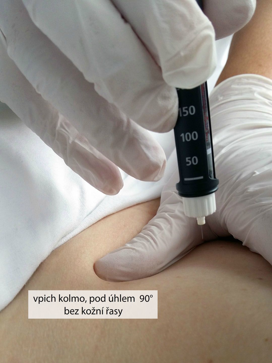 Aplikace s.c. injekce inzulinovým perem do břicha