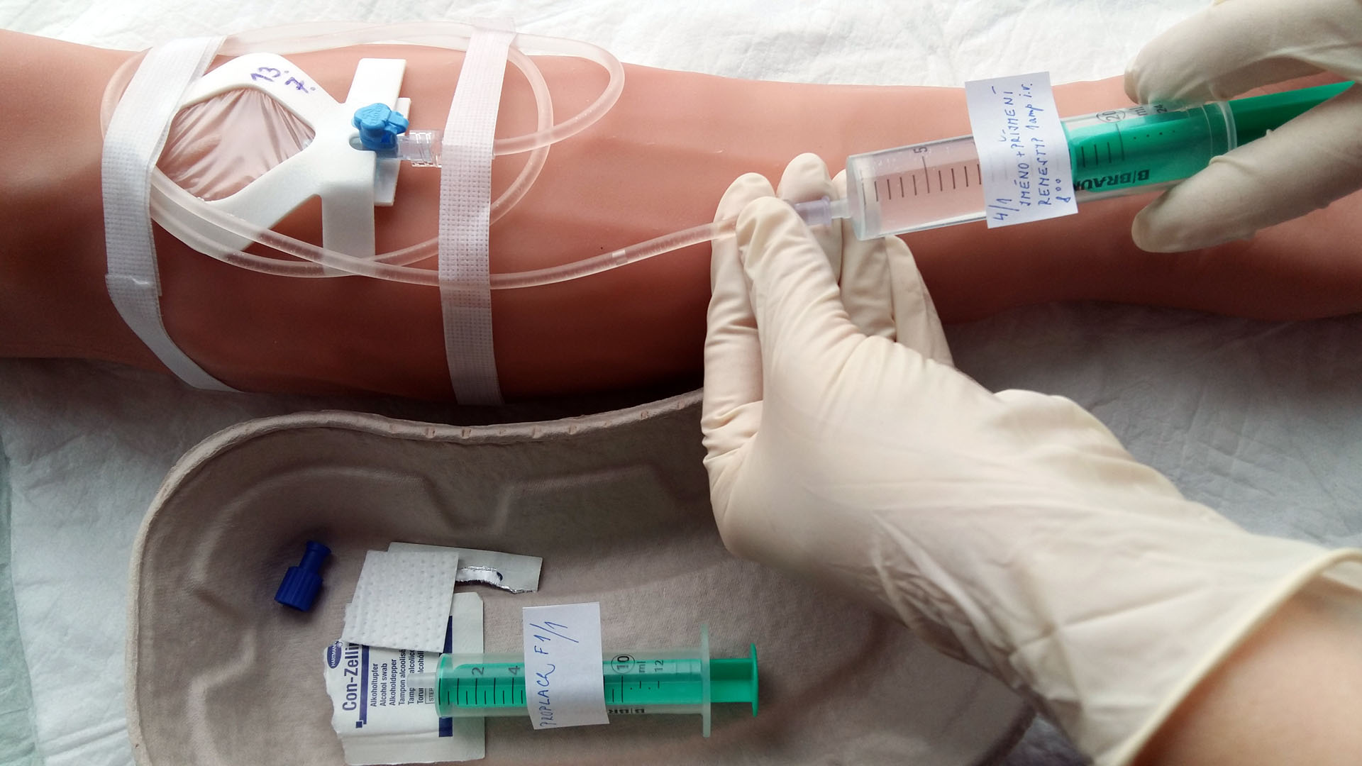 Intravenous administration of the drug to the peripheral venous catheter wi...