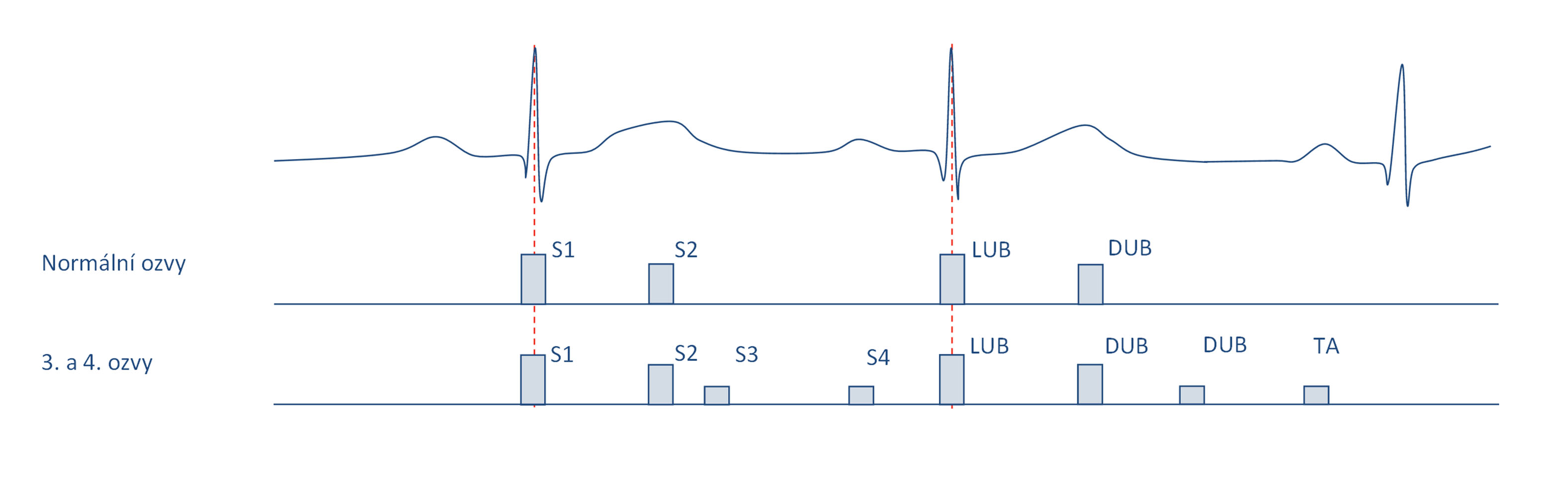 Schéma časového umístění ozev vůči signálu EKG