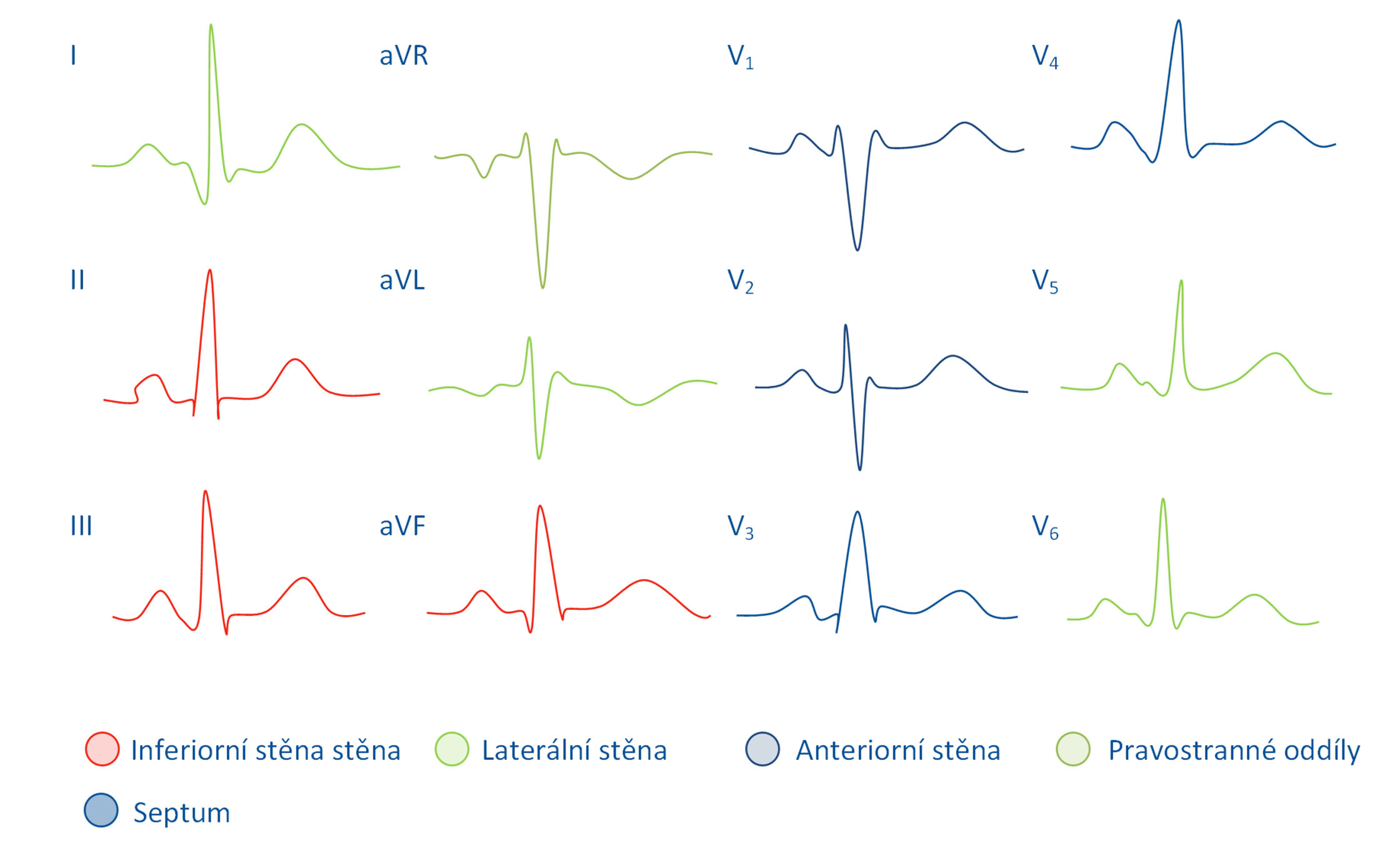 Dvanácti svodový záznam EKG se zvýrazněním anatomického původu vzniku jednotlivých křivek