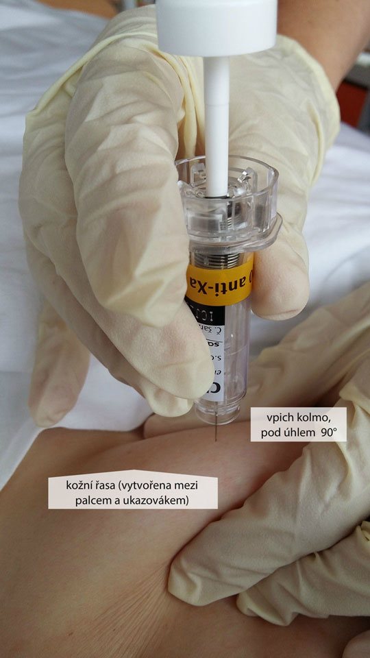 Aplikace s.c. injekce do břicha – nízkomolekulární heparin