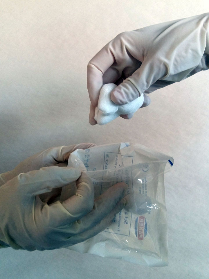 Vytažení sterilních tamponů k dezinfekci genitálu